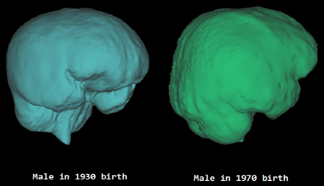 1930년대 출생 한국인과 1970년대 한국인 두개강의 가상 3차원 모델