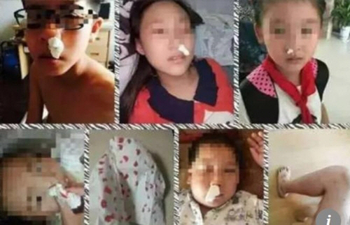 독성 물질이 포함된 학교 트랙으로 인해 코피 흘리는 중국 어린이들./연합뉴스