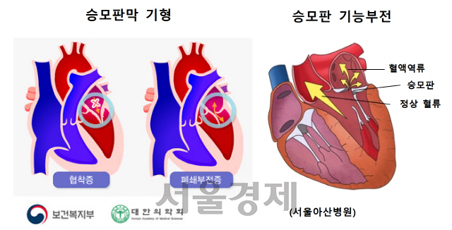 서울성모병원도 심장 인공승모판막 이식시술 성공 8801