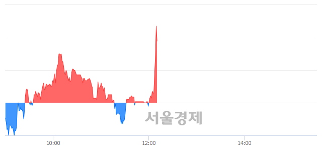 <코>비덴트, 매수잔량 344% 급증