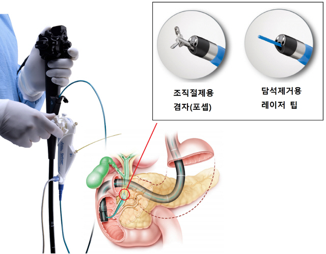 담관내시경 ‘스파이글래스 DS’ 개념도