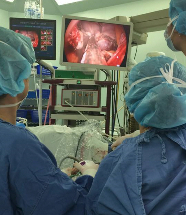 양윤석 을지대병원 산부인과 교수팀이 V-노츠로 자궁을 적출하는 수술을 하고 있다. /사진=양윤석 교수 블로그