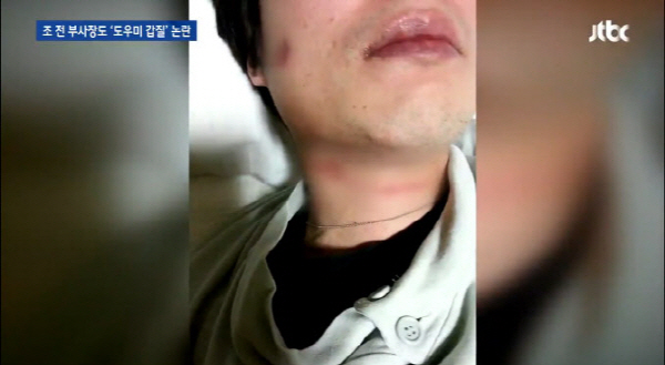 조현아 남편 ‘가정폭력’ 증거, 심하게 목 졸린 사진 “아이패드 던져서 발가락 절단”