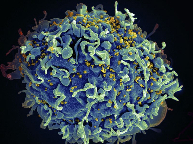 인간면역세포(파란색)를 감염시키는 에이즈 바이러스(노란색). /사진제공=미국 국립보건원(NIH)