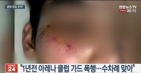 ‘재수사 2주 만에 가해자 입건’ 부실수사 의혹? cctv 확보해놓고 “특정 불가능”