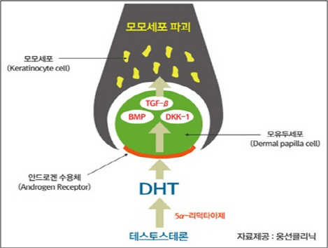 기존 탈모치료제 ‘프로페시아’는 남성호르몬인 테스토스테론이 탈모유발 물질로 알려진 DHT로 변환되는 것을, 바이오니아의 탈모 완화 후보물질은 DHT가 모근세포로 들어가는 길잡이 역할을 하는 안드로겐 수용체 생성을 억제한다.