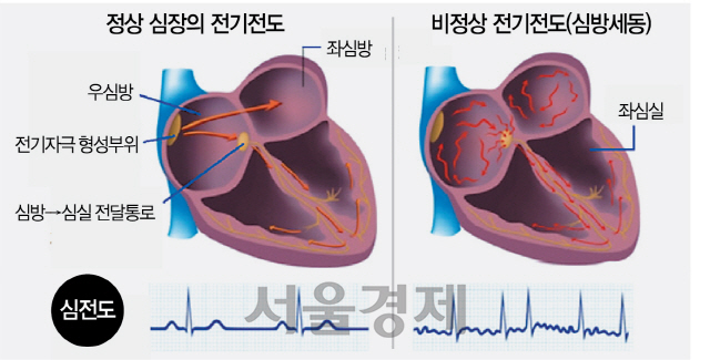 2315A34 건강