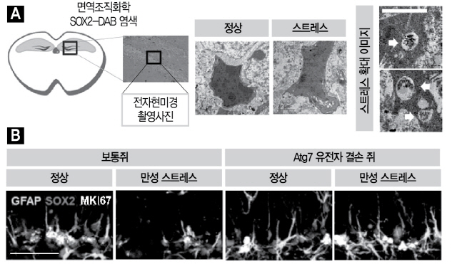 스트레스를 줘 오토파지를 유도하고 오토파지 유전자를 억제해 신경줄기세포를 보호한 실험결과. /사진제공=DGIST