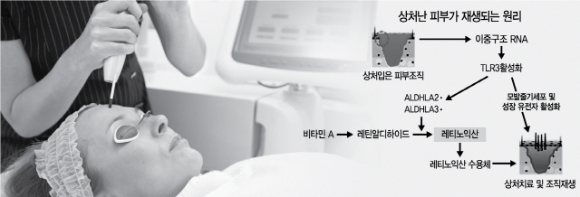 [사이언스] '레이저 시술로 피부 탄력' 원리 규명..피부재생·발모 치료제 개발 길 열어