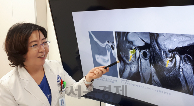 한상선 연세대 치과대학병원 영상치의학과 교수가 제자리를 크게 이탈한 턱관절 디스크(쑥색의 U자형 구조물)를 알기 쉽게 표시한 자기공명영상(MRI)을 보여주며 턱관절 디스크증에 대해 설명하고 있다. /사진=임웅재기자