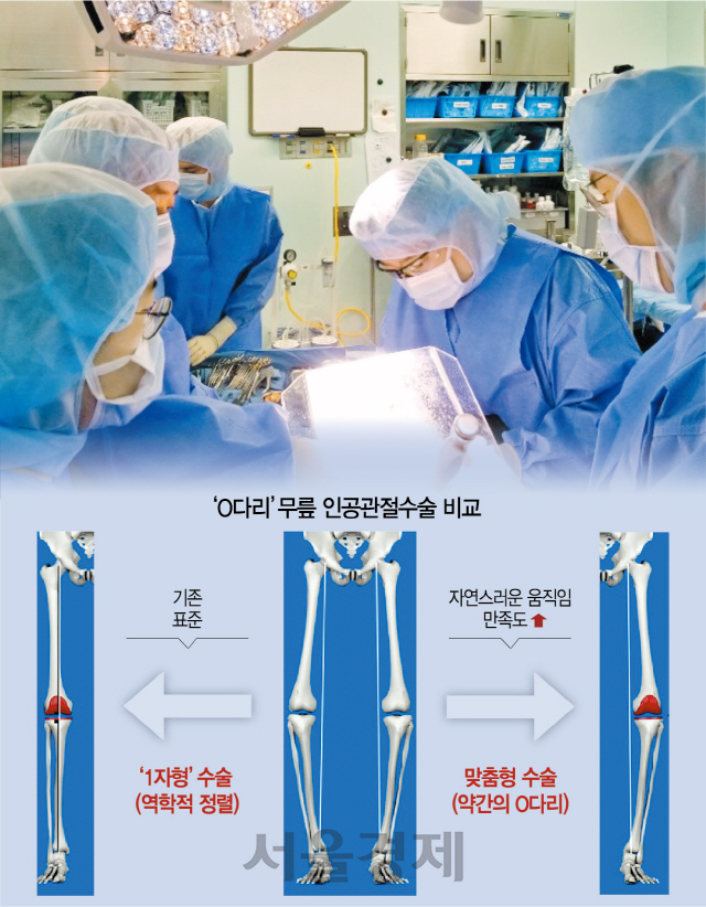 고인준 가톨릭대 은평성모병원 정형외과 교수팀이 무릎 인공관절수술을 하고 있다. /사진제공=은평성모병원