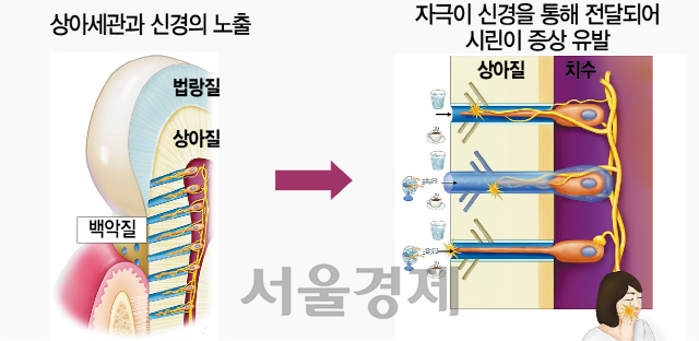 2915A34 시린이