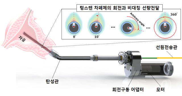 근접방사선 치료 삽입기구 개념도