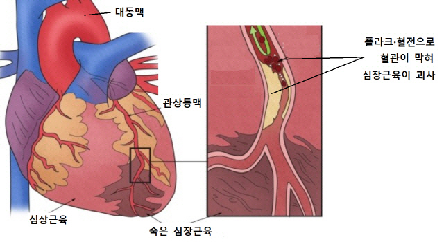 (출처: 서울아산병원)