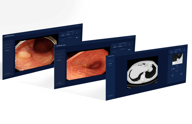 제이엘케이인스펙션 AI 의료영상분석 솔루션의 분석화면