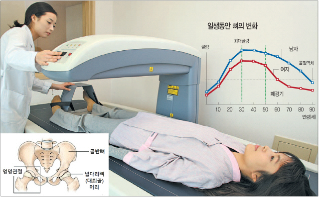 골다공증 예방·관리를 위해서는 칼슘·비타민D를 최대한 음식으로 섭취하고 부족분을 저용량 보충제로 채워줄 필요가 있다. 40대 여성이 골밀도 검사를 받고 있다. /사진제공=서울아산병원