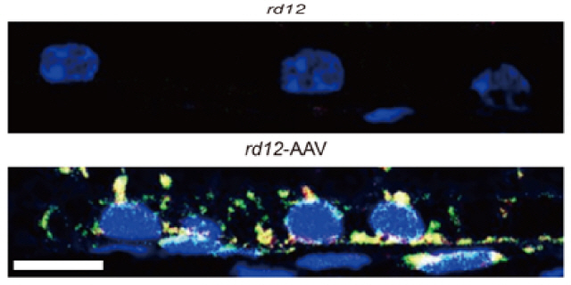 선천성 실명을 유발하는 돌연변이 유전자를 가진 rd-12 생쥐의 망막색소상피세포(사진 위)와 유전자 교정치료 후 정상 단백질이 합성된 망막색소상피세포(아래). /사진제공=서울대병원