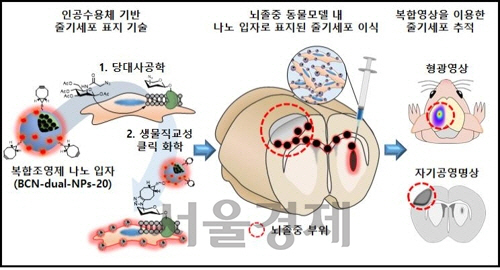 복합조영제 나노입자가 표지된 줄기세포의 추적 영상 기술의 모식도. /사진제공=KIST