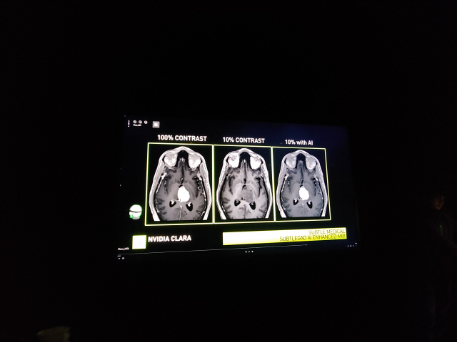 엔비디아의 의료 AI 클라라 방사선 분석 화면/백주원기자