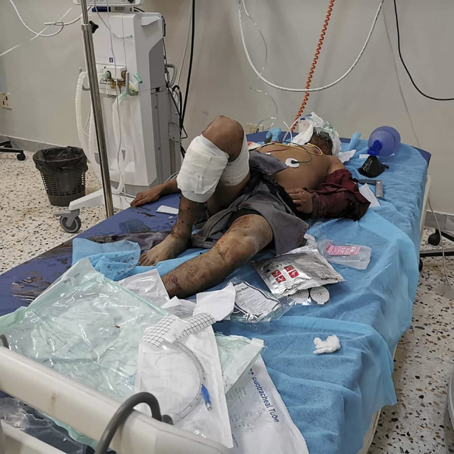 18일(현지시간) 비스킷 공장을 강타한 공습으로 부상당한 한 남자가 리비아의 수도 트리폴리의 한 병원에서 치료를 받고 있다./AP
