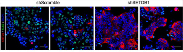 대장암세포가 정상세포로 되돌려지는 과정을 담은 이미지. 대장암세포에서 SETDB1 발현을 억제하자 점차 정상세포들(빨간색)이 발생하고 있다. /이미지제공=KAIST