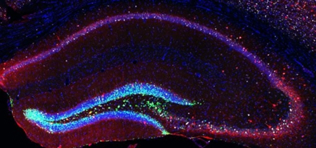 신경줄기세포를 자극한 늙은 생쥐의 뇌 신경줄기세포를 자극했더니 기억중추인 해마 부위 신경세포(녹색)가 많이 생겨나 기존 신경망(적색)과 연결돼 뇌 기능이 정상 수준으로 복원됐다. /사진제공=드레스덴공대 재생치료센터(CRTD)