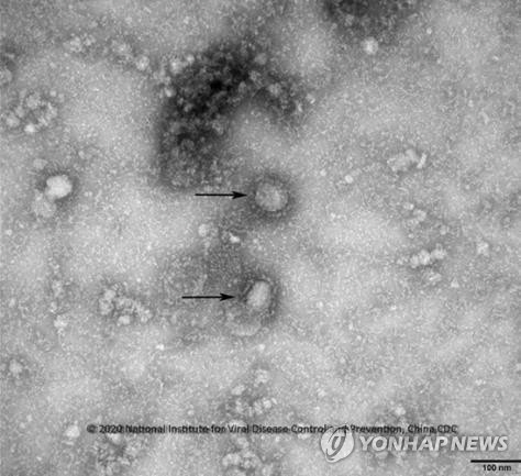 전자현미경 통해 본 중국 우한 코로나바이러스./질병관리본부 제공