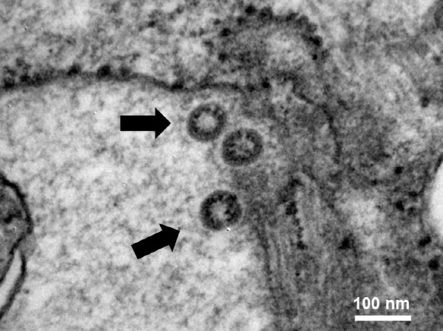 왕관 모양의 돌기들이 바이러스 입자를 둘러싼 신종 코로나바이러스를 전자현미경으로 확대한 모습. ‘코로나’는 라틴어로 왕관을 뜻한다. /사진제공=서울대병원 감염내과