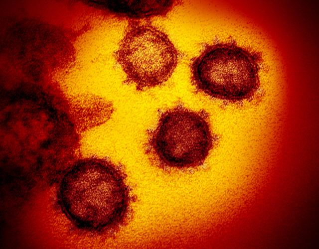 FILE - This undated electron microscope image made available by the U.S. National Institutes of Health in February 2020 shows the Novel Coronavirus SARS-CoV-2. Also known as 2019-nCoV, the virus causes COVID-19. The sample was isolated from a patient in the U.S. On Friday, Feb. 21, 2020, The Associated Press reported on a video circulating online incorrectly asserting that man in Wuhan, China, was sanitizing his apartment with alcohol when the air conditioner came on and caused an explosion and fire. The fire captured on video was the result of a cigarette that was improperly put out on a comforter. The comforter then ignited and was placed on a balcony where nearby debris caught fire in Chongqing, China, a city hundreds of miles away from Wuhan. (NIAID-RML via AP)        <저작권자(c) 연합뉴스, 무단 전재-재배포 금지>