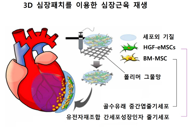 '복합 줄기세포 3D패치'로 손상된 심장근육 재생 성공