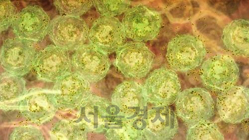염증 신호를 받아 항체(갈색)를 만드는 B세포(녹색)의 모습. /사진=월터&엘리자홀의학연구소