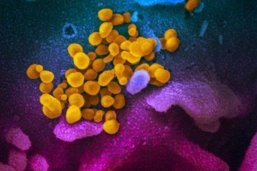 코로나19 바이러스 전자 현미경 영상. /미 NIH 국립 알레르기 감염병 연구소