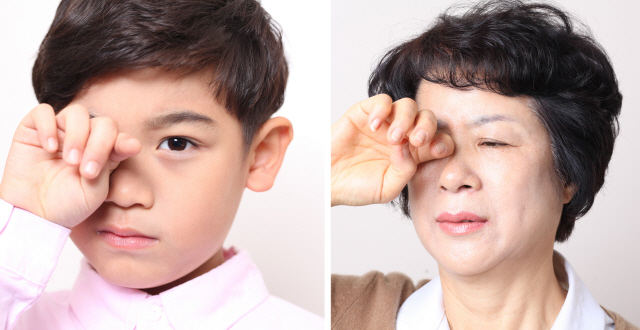 속눈썹이 눈을 찌르는 질환 중 덧눈꺼풀은 어린이와 젊은층에서, 눈꺼풀 속말림은 노인에서 주로 나타난다. /사진제공=김안과병원