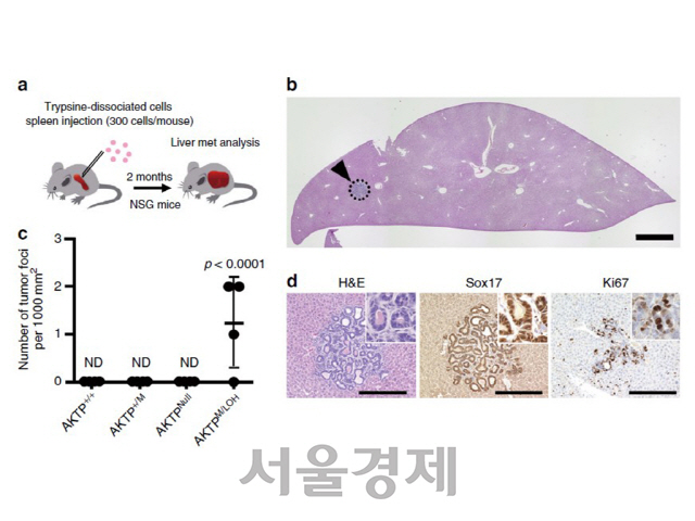 이형접합성 손실과 P53 유전자 변이에 의한 암의 전이(동물실험 결과)