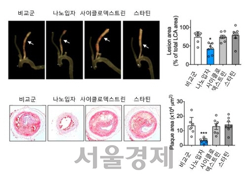 사이클로덱스트린-스타틴 나노 입자의 플라크 제거 효과. /KAIST