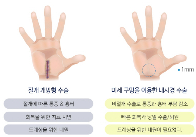 손 힘빠지고 통증이 있다면 혹시 손목터널증후군?