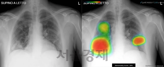 루닛 AI 기술로 코로나19의 폐 엑스레이를 판독하는 모습. /사진제공=루닛