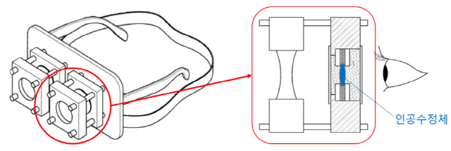 백내장 수술 전 눈에 넣어줄 다초점·단초점 인공수정체를 미리 경험해볼 수 있는 ‘안경형 시뮬레이터’ 개념도.