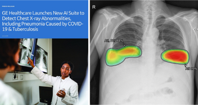흉부X레이 사진을 분석해 코로나19·결핵에 의한 폐렴 등 이상 소견이 보이는 부위와 의심 정도를 색상·수치로 보여주는 루닛의 인공지능 소프트웨어(AI SW·사진 오른쪽), 이를 탑재한 X레이 장비 등 신제품 출시 계획을 밝힌 GE헬스케어의 보도자료(왼쪽).