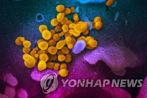 신종 코로나바이러스의 전자 현미경 영상 /미 NIH 국립 알레르기 감염병 연구소 제공, 연합뉴스