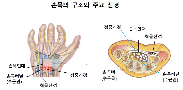 ‘언택트’로 손목 통증↑…'신경 글라이딩 운동 해보세요'
