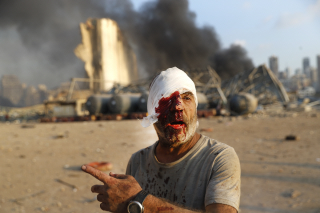 지중해 연안국가인 레바논의 수도 베이루트에서 4일(현지시간) 대규모 폭발사고로 최소 100여명이 숨지고 4,000여명의 부상자가 발생했다. 사고현장에서 부상한 한 남성이 머리를 붕대로 감싼 채 피를 흘리고 있다. /AP연합뉴스