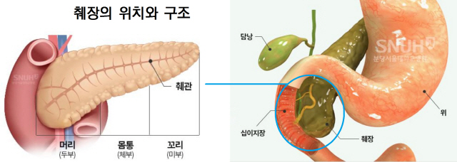 대한민국 췌장암 5년생존율 '세계 최고'