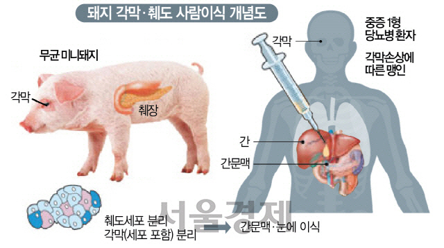 돼지 췌도·각막 등 이식 '연구자 임상시험' 승인 신청