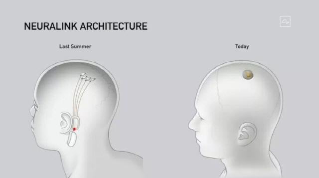 일론 머크스가 작년 7월 전극고 모듈이 별도로 있는 컴퓨터 칩(왼쪽)과 28일 공개한 둘을 합친 컴퓨터 칩을 비교한 모습. /뉴럴링크