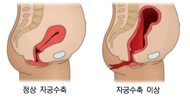 *출처: 서울아산병원