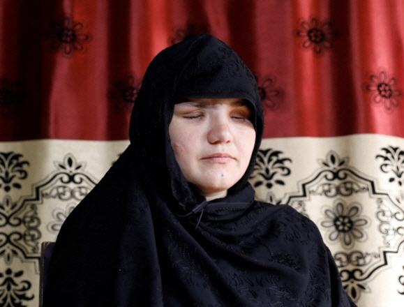 직업을 가졌다는 이유로 아버지의 사주를 받은 탈레반 괴한들로부터 두 눈을 공격받아 실명하게 된 아프가니스탄 여성 카테라(33). 카테라는 경찰이 된 지 3개월 만에 끔찍한 범죄 피해를 입고 현재 치료를 받고 있다. 사진은 지난 10월 12일 수도 카불에서 인터뷰하는 모습. /로이터 연합뉴스