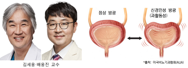 난치 신경인성·과활동성 방광, 줄기세포로 치료 '파란불'