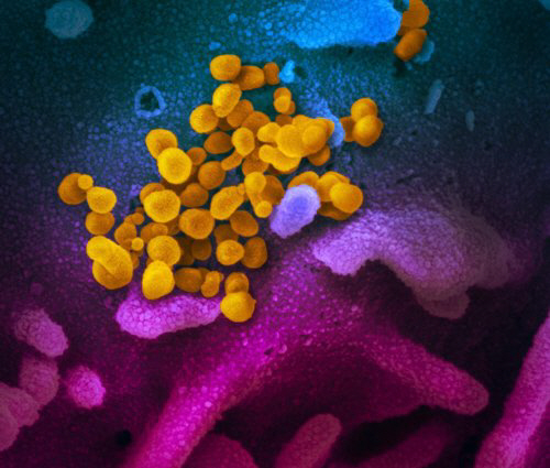 신종 코로나바이러스의 전자 현미경 영상./미 NIH 국립 알레르기 감염병 연구소 홈페이지 캡처