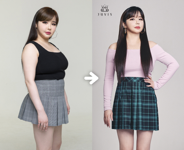 박봄 ’70kg ~ 11kg 감량 … ADD 치료로 다이어트 힘들었다’
